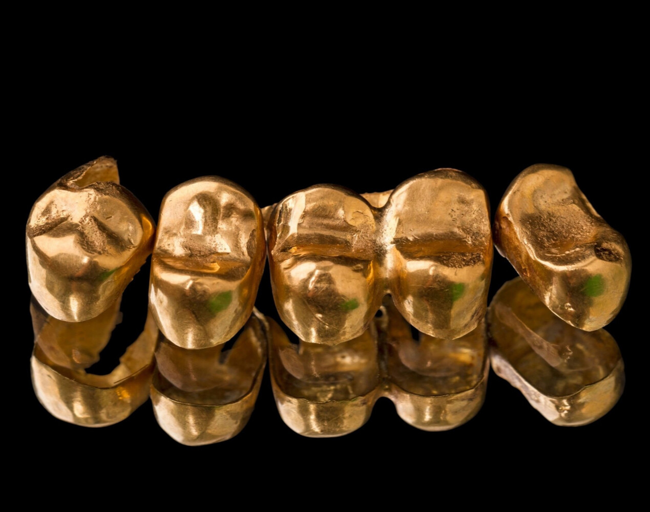 Скупка  стоматологического золота в Санкт-Петербурге